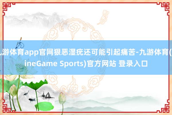 九游体育app官网狠恶湿疣还可能引起痛苦-九游体育(NineGame Sports)官方网站 登录入口